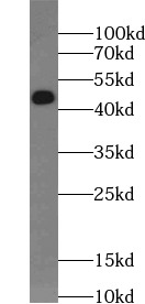      anti- ACAA1 antibody