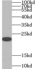      anti- AANAT antibody