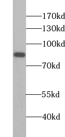 anti- AARE antibody