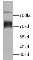      anti- ABCF2 antibody