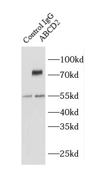 ABCD2抗体