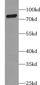      anti- ABCD2 antibody