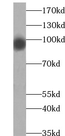      anti- ABCF1 antibody