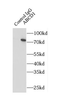      anti- ABCD1 antibody