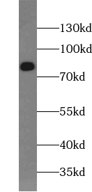      anti- ABCD1 antibody