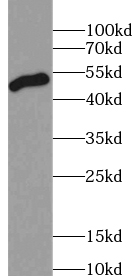      anti- AAMP antibody