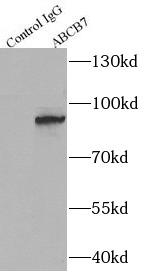 ABCB7抗体