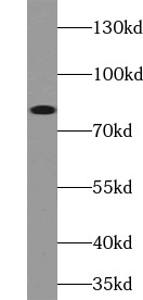 anti- ABCB7 antibody