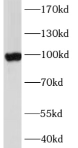 anti- ABCG1 antibody