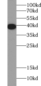 anti- A4GNT antibody