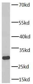      anti- 14-3-3 antibody