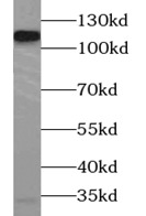 anti- AARS2 antibody