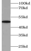 anti- ABAT antibody