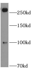      anti- ABCA2 antibody