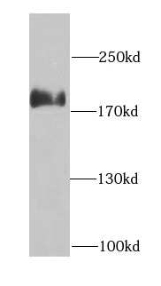 anti- ARHGAP5 antibody