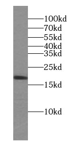 anti- ARMETL1 antibody