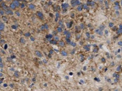 anti- ARPP-19 antibody