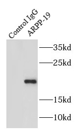 anti- ARPP-19 antibody