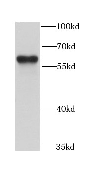 anti-ARFGAP3 antibody