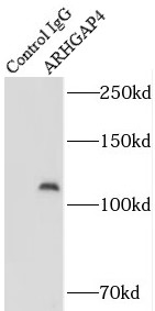      anti- ARHGAP4 antibody