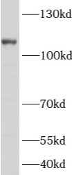      anti- ARHGAP4 antibody