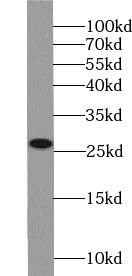 anti- ARHGDIB antibody