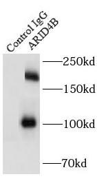      anti-ARID4B antibody