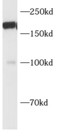      anti- ARID4B antibody