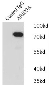      anti- ARID3A antibody