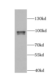      anti- ARID3A antibody