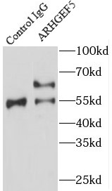      anti- ARHGEF5 antibody