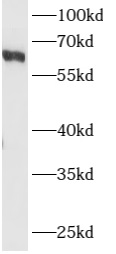      anti- ARHGEF5 antibody