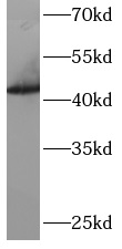      anti- ARFGAP1 antibody