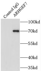 ARHGEF7抗体