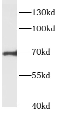      anti- ARHGEF7 antibody