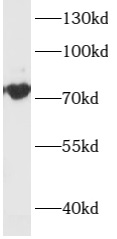 anti- ARHGEF4 antibody