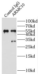 anti- ARMC10 antibody