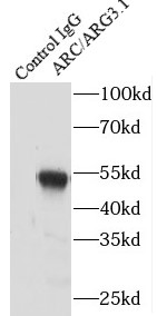      anti- ARC/ARG3.1 antibody