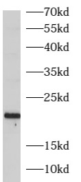      anti- ARL3 antibody