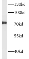 anti- ARK5 antibody