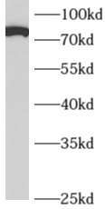      anti- APPL1 antibody