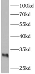      anti- ARAF antibody