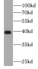 anti- ARG2 antibody