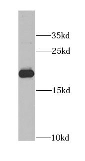 anti- APRT antibody