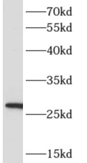      anti- ARD1A antibody