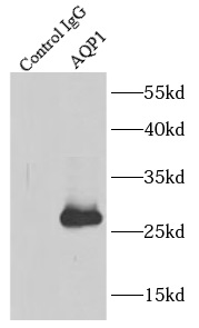      anti- AQP1 antibody