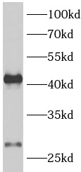      anti- AQP1 antibody