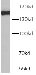      anti- AQR antibody