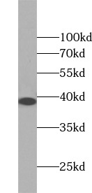      anti- ANXA9 antibody