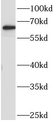      anti- AOAH antibody